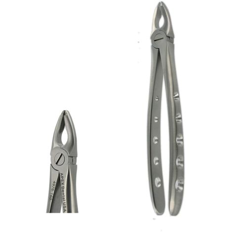 F3 UPPER ANTERIOR